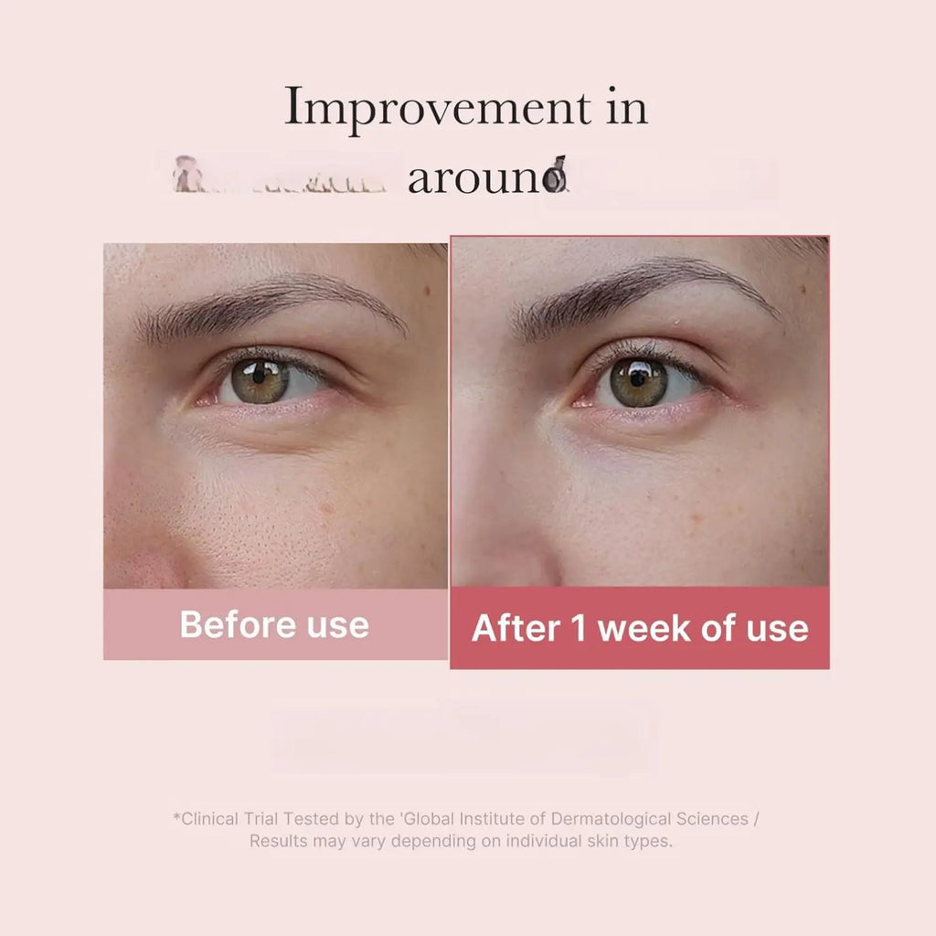 Medicube Salmon DNA PDRN Eye Serum – Peptide, Niacinamide & 99% Retinol