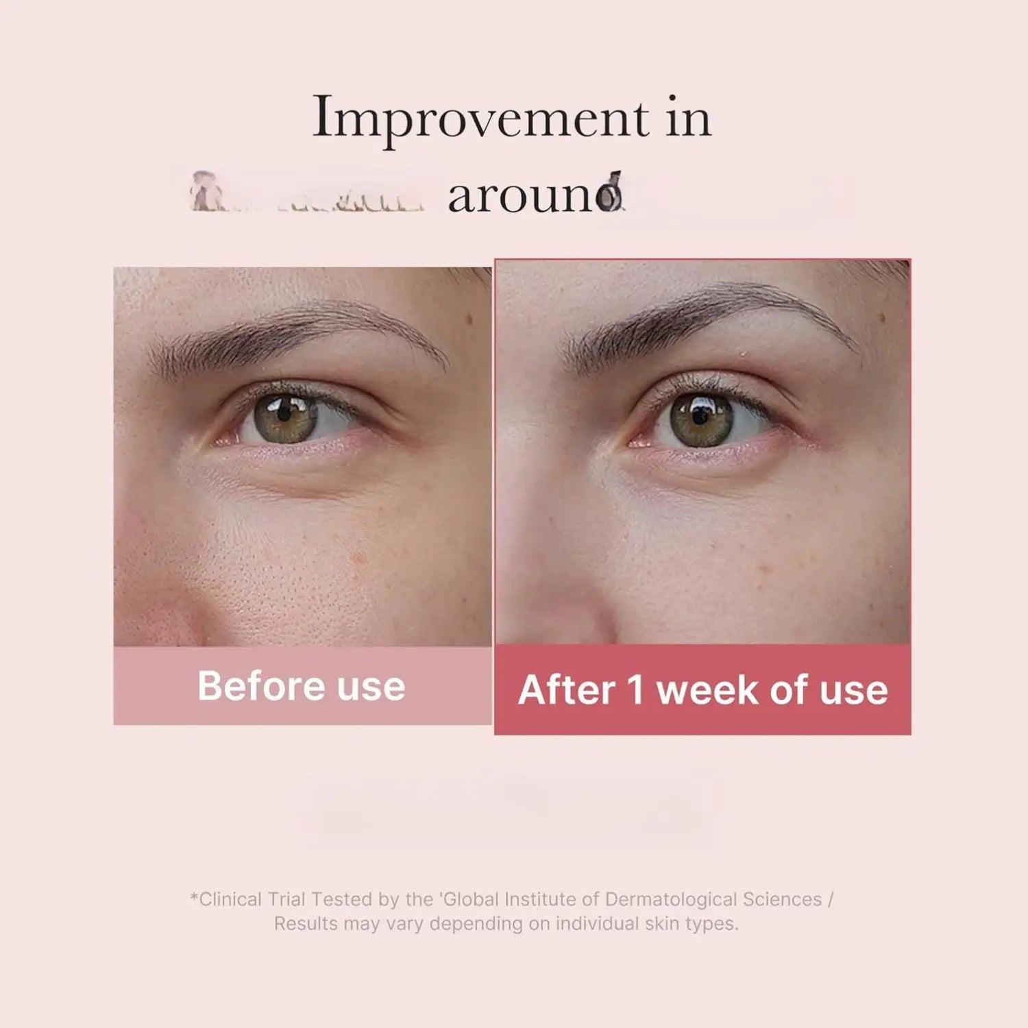 Medicube Salmon DNA PDRN Eye Serum – Peptide, Niacinamide & 99% Retinol